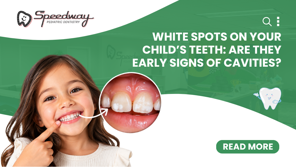 Child showing her teeth with visible white spots that may be early signs of tooth decay.